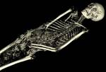 The CT scan of the mummy of an adult male (name unknown), showing his skeleton. © Trustees of the British Museum.