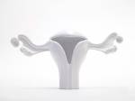 David Brognon (the Plug) & Stephanie Rollin, Uterus Vase (2008). Courtesy of the artists. Photograph ©Andres Lejo 2012.