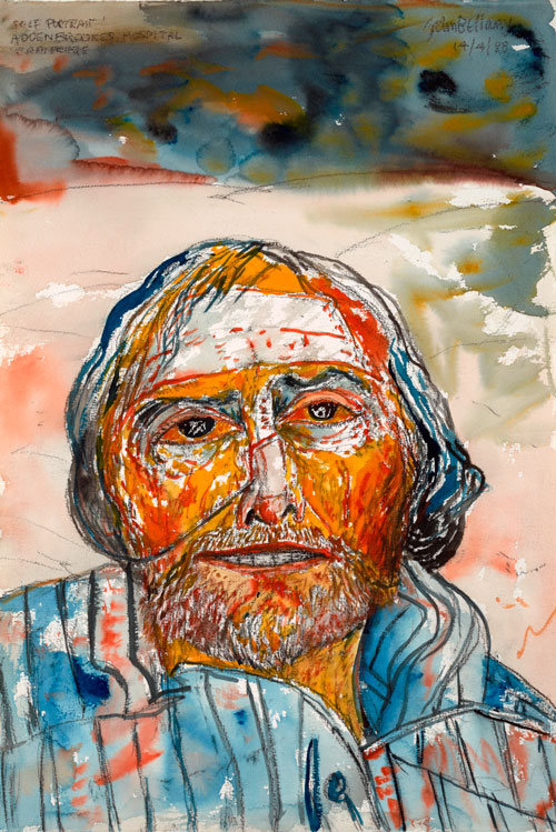 John Bellany. Self-Portrait (from the Addenbrooke’s Hospital Series), 1988. Watercolour on paper, 57 x 38.6 cm. Scottish National Gallery of Modern Art.