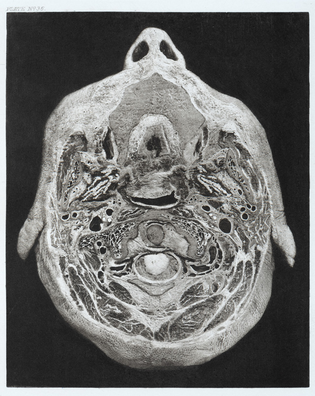 Horizontal section of the head in Atlas of head sections. Prepared by William MacEwen, drawings by Miss MacEachran, photogravure by Messrs Annan of Glasgow. Published Edinburgh, 1893. © Royal College of Physicians. Photo: Mike Fear.